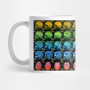 Coloured MRI scans of a healthy human brain (P332/0331) Mug